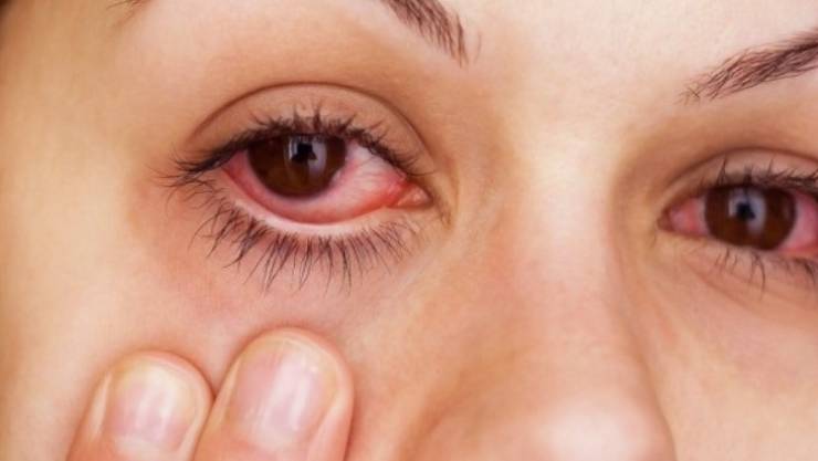 طرق الوقايه من التهاب العين